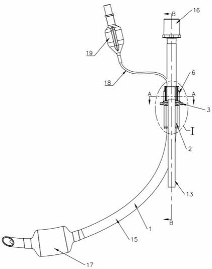 一种带自锁型可移动牙垫的气管插管的制作方法