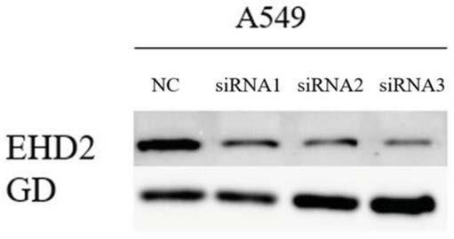 靶向EHD2基因的siRNA及其应用的制作方法