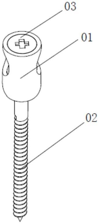 一种钛铝合金脊髓固定钉精密电解加工方法与流程