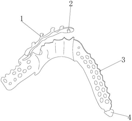 一种铰链锁扣数字化义齿支架的制作方法