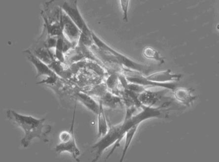 一种小鼠淋巴瘤相关成纤维细胞肿瘤细胞HXLyAF-KT及其应用