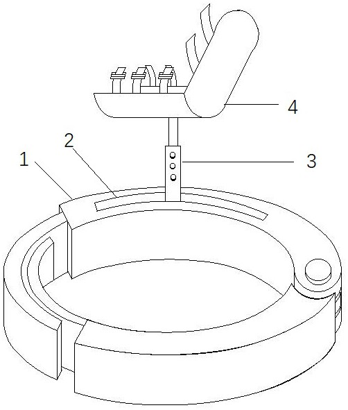 肘关节外固定器的制作方法