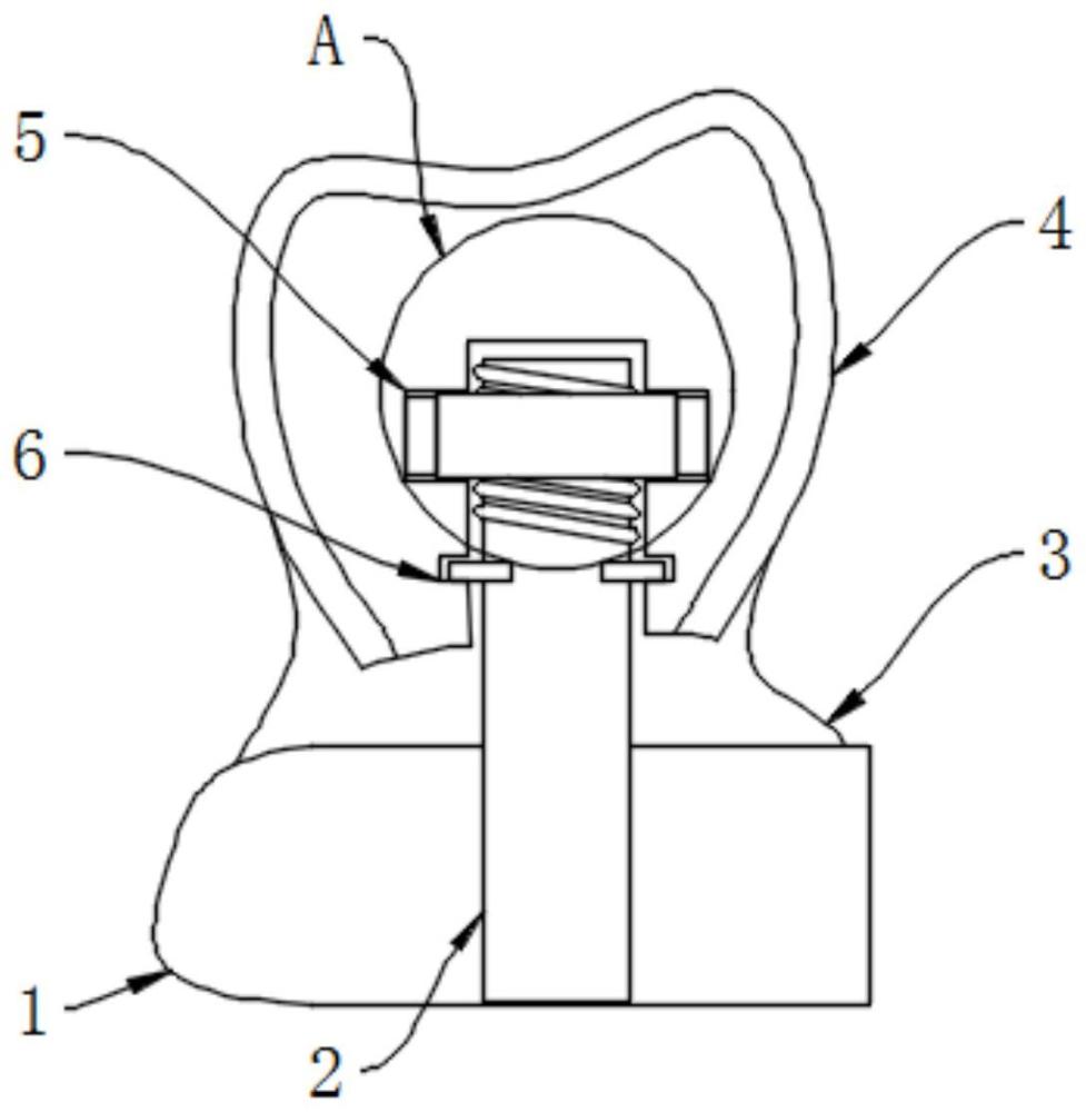 一种新型氧化锆全瓷义齿的制作方法