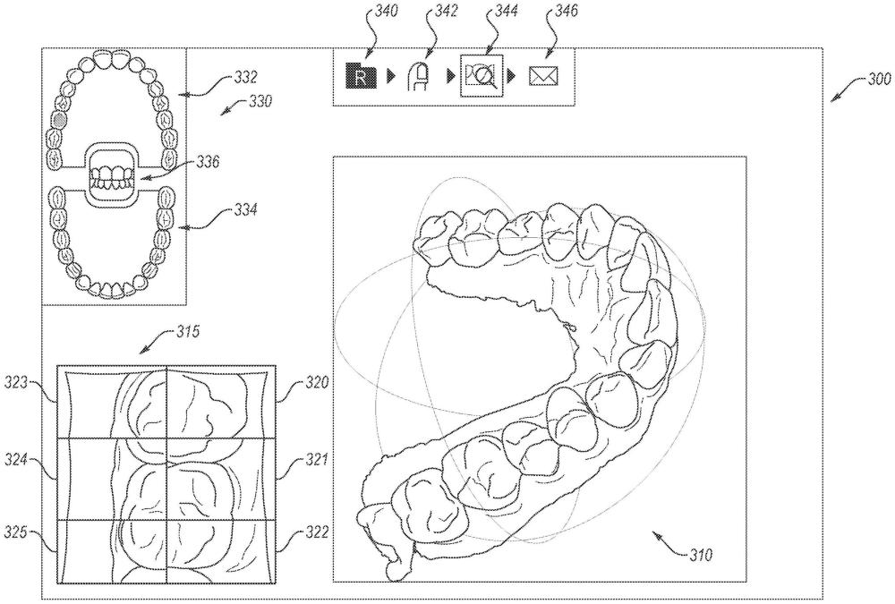 口内扫描仪实时和扫描后可视化的制作方法