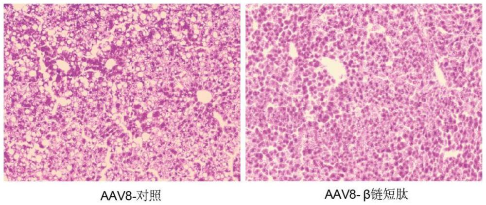 LRP1-β链短肽在治疗非酒精性脂肪肝中的应用