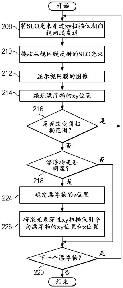 评估和治疗眼睛漂浮物的制作方法