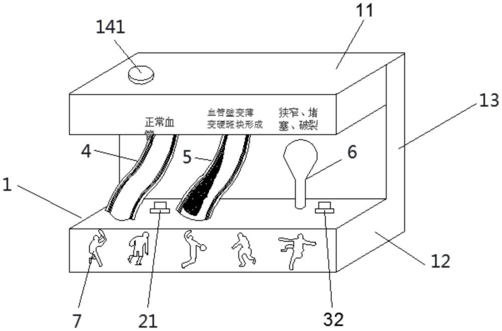 血压管理宣教模型的制作方法