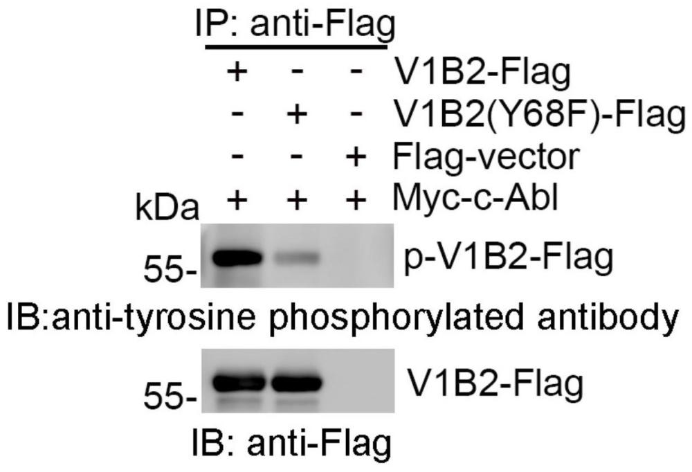 一种特异性识别Y68磷酸化ATP6V1B2蛋白的抗体及其制备方法和应用