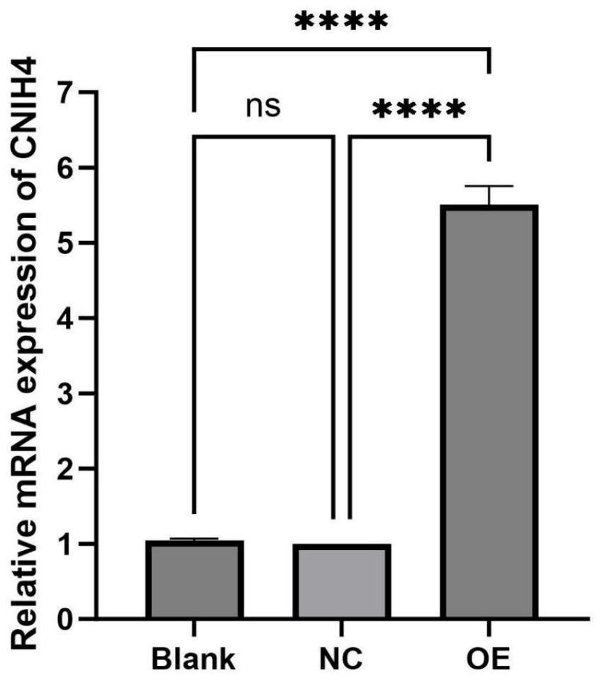 CNIH4作为宫颈癌生物标志物和治疗靶点的应用