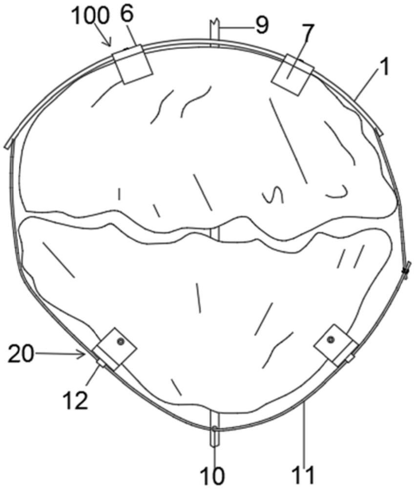 弓状弹性髌骨骨折内固定装置的制作方法