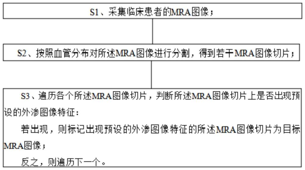 基于MRA的临床患者造影外渗可视化检查方法和系统与流程