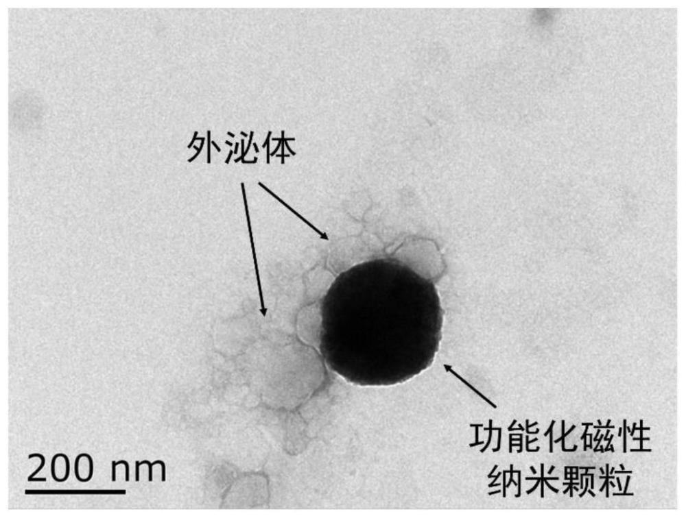 一种功能化磁性纳米粒子与外泌体的复合制剂及其制备方法和应用