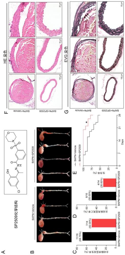 组蛋白去甲基化酶抑制剂SP2509在制备预防和治疗主动脉夹层的药物中的应用