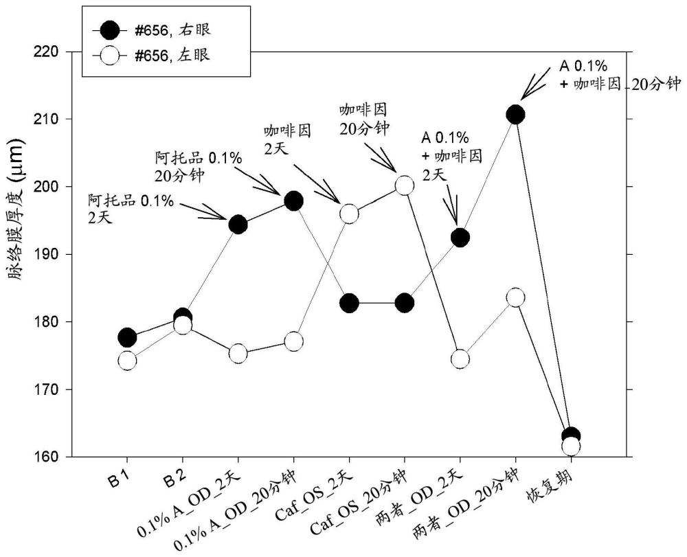 用于控制和/或降低近视发展的药物组合物的制作方法