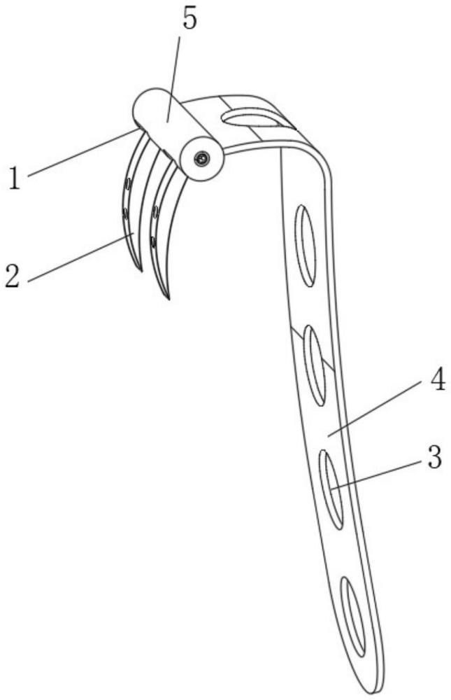 一种近关节双倒钩解剖型钢板的制作方法