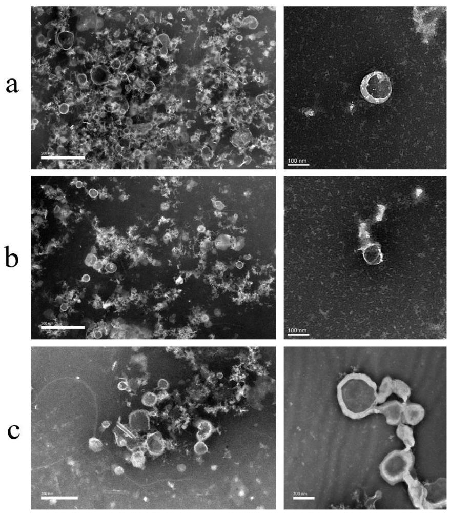 一种植物外泌体样纳米颗粒及其提取方法