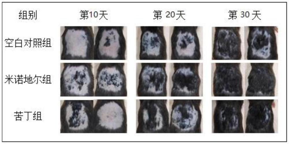 一种5α-还原酶抑制剂及其在防脱育发产品中的应用的制作方法