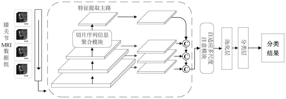 一种基于MRI切片序列聚合的前交叉韧带损伤分类方法