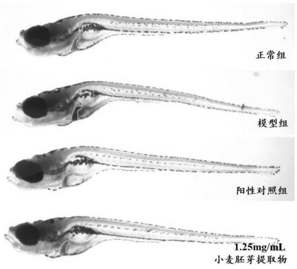 一种小麦胚芽提取物及其制备方法和应用与流程