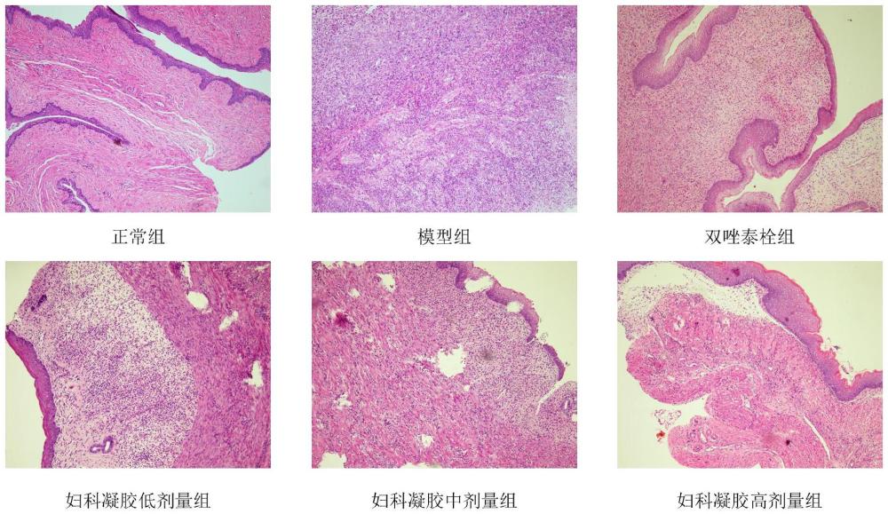 一种防治盆腔炎的中药组合物及其制备方法和应用