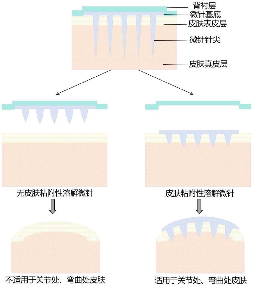 一种皮肤表面快速成膜的粘附性微针贴片及其制备方法和应用