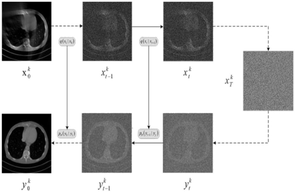 一种基于扩散模型的有限角度CT重建系统