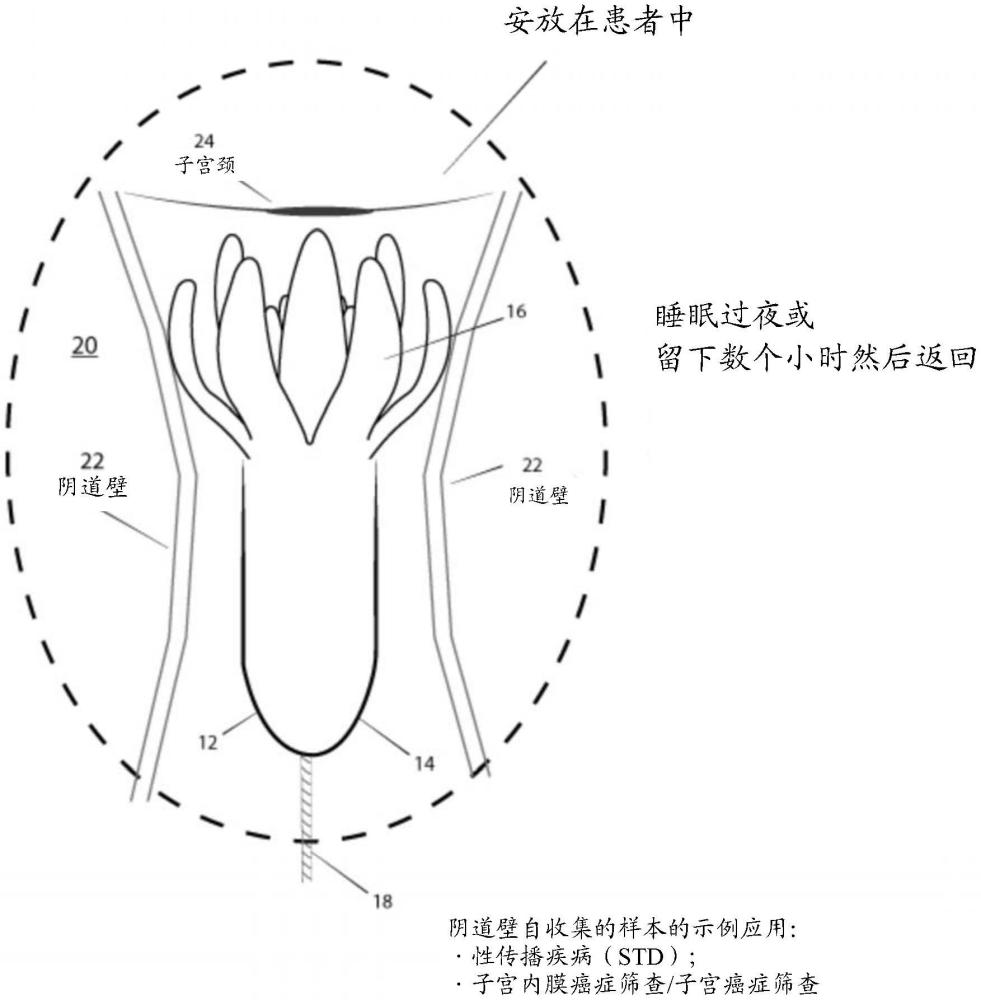 具有用于宫颈和肛门自收集样本的可膨胀刷的装置和方法与流程