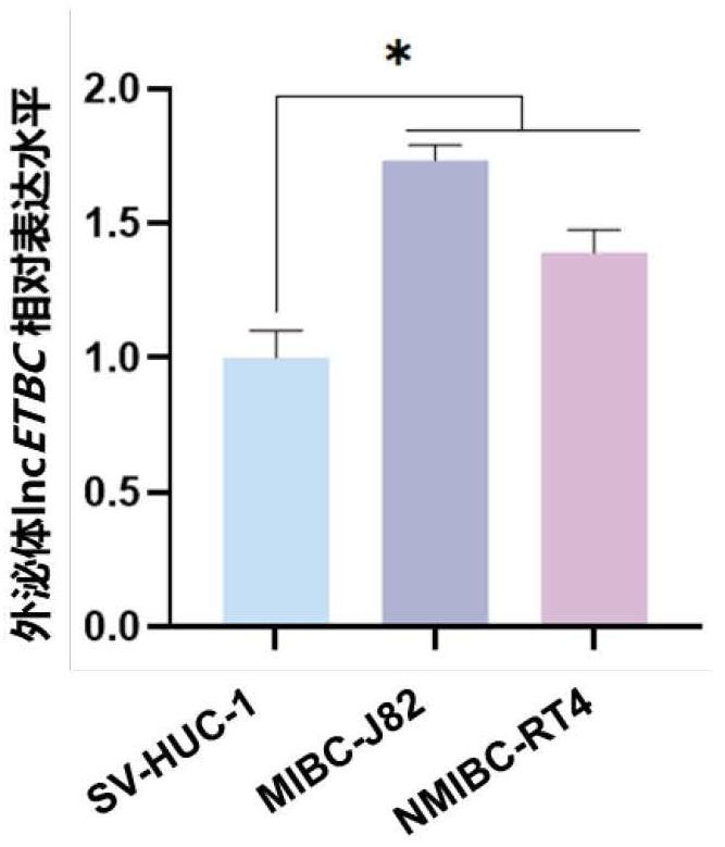 膀胱癌辅助诊断的体液外泌体长链非编码RNA生物标志物及其应用