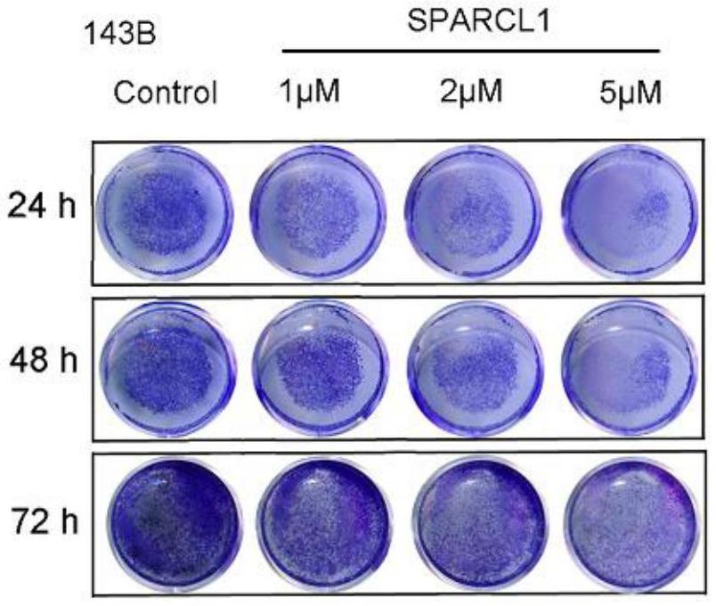 SPARCL1在制备预防或治疗骨肉瘤药物中的用途