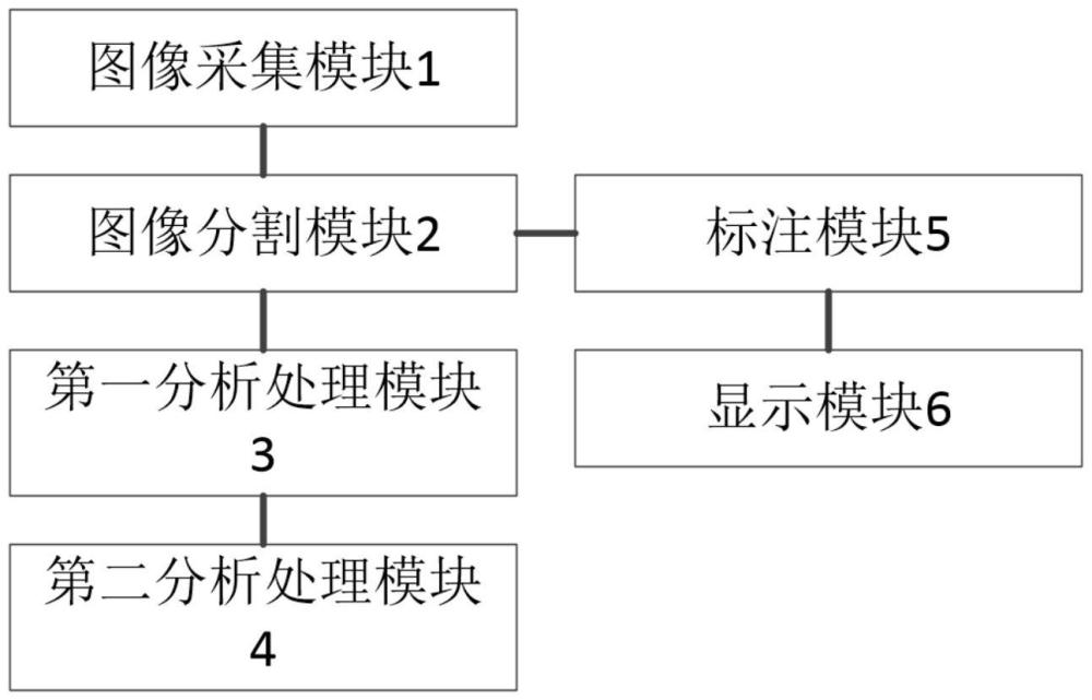 一种基于深度学习的颈动脉超声扫查导航系统和方法与流程