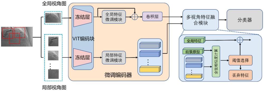 冠心病辅助诊断系统、系统操作方法及诊断装置