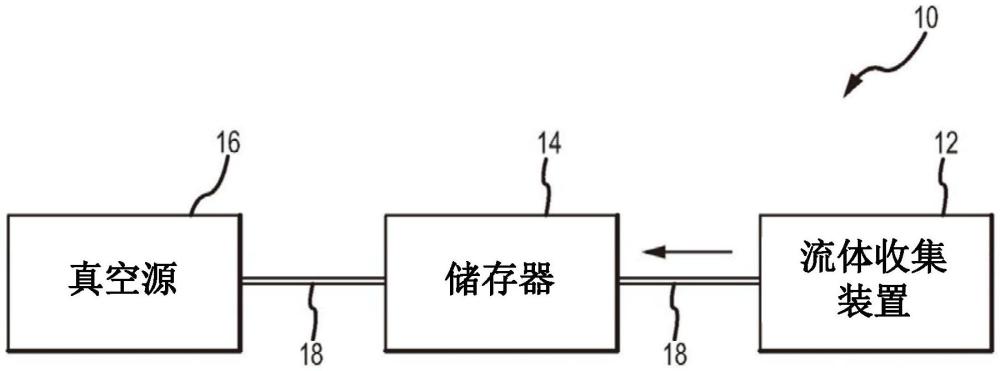 具有改进触觉反馈的外部导管及相关系统和方法与流程