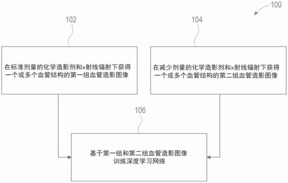 用于使用机器学习的血管造影剂量减少的系统和方法与流程