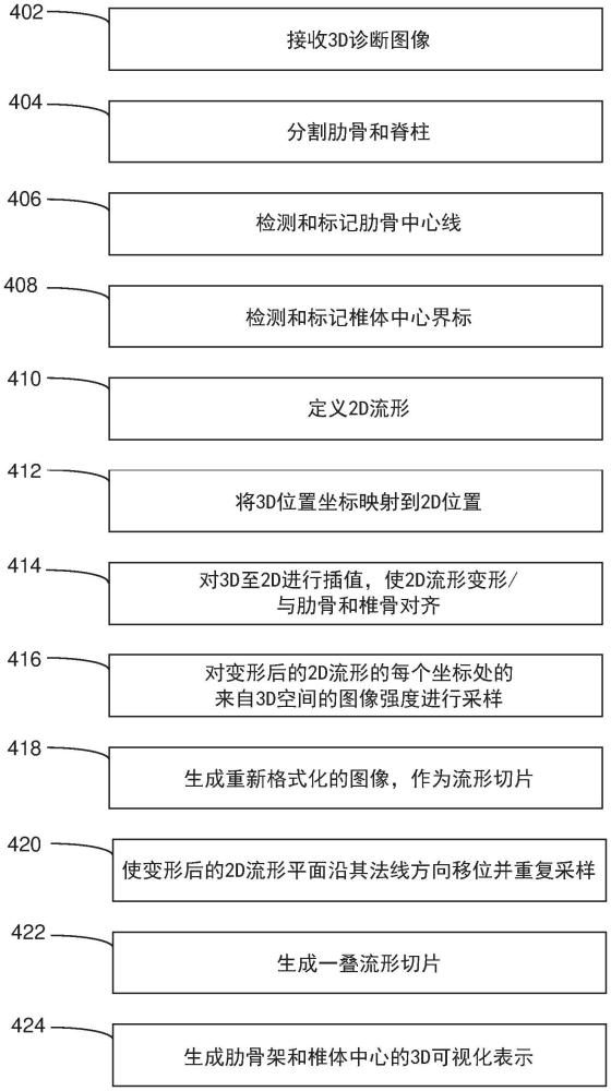 用于快速评估扫描的组合的肋骨和脊柱图像处理的制作方法