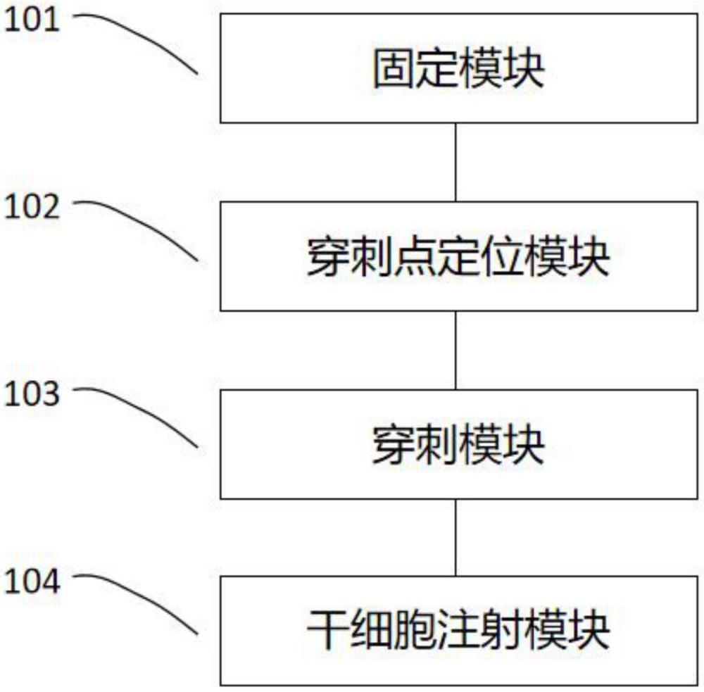 一种神经内镜下经鼻嗅区粘膜下干细胞移植系统和装置